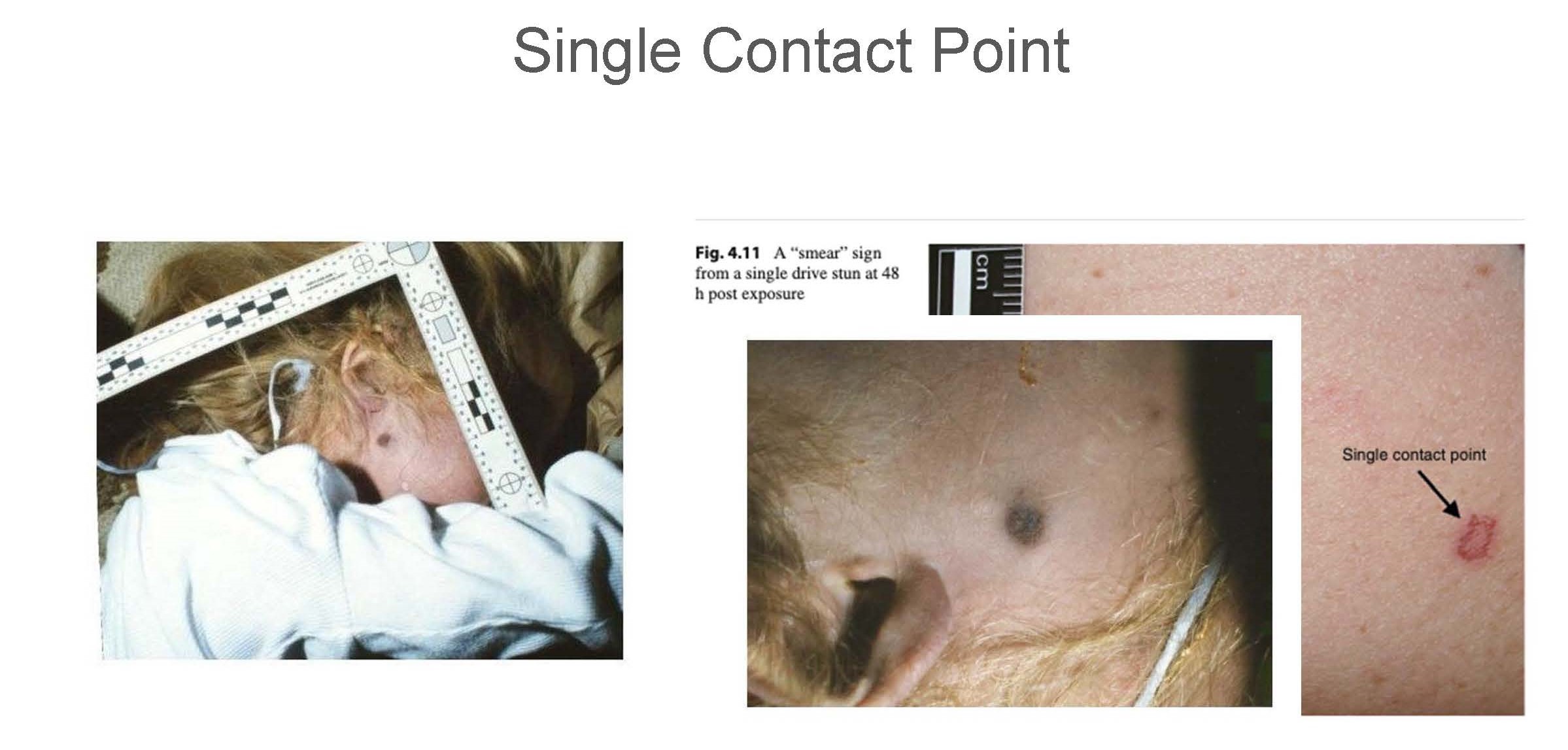 Single Contact Point